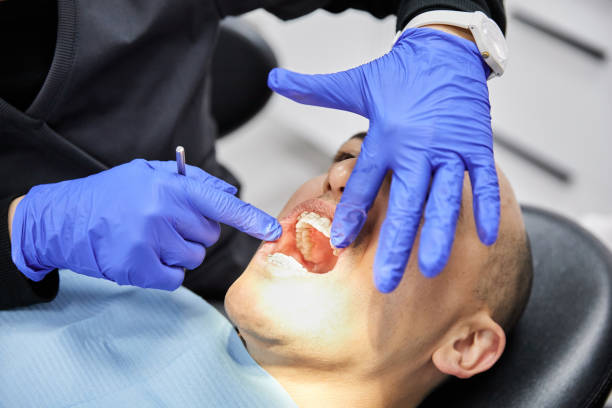 Best Broken or Chipped Tooth Repair in Rushville, IN